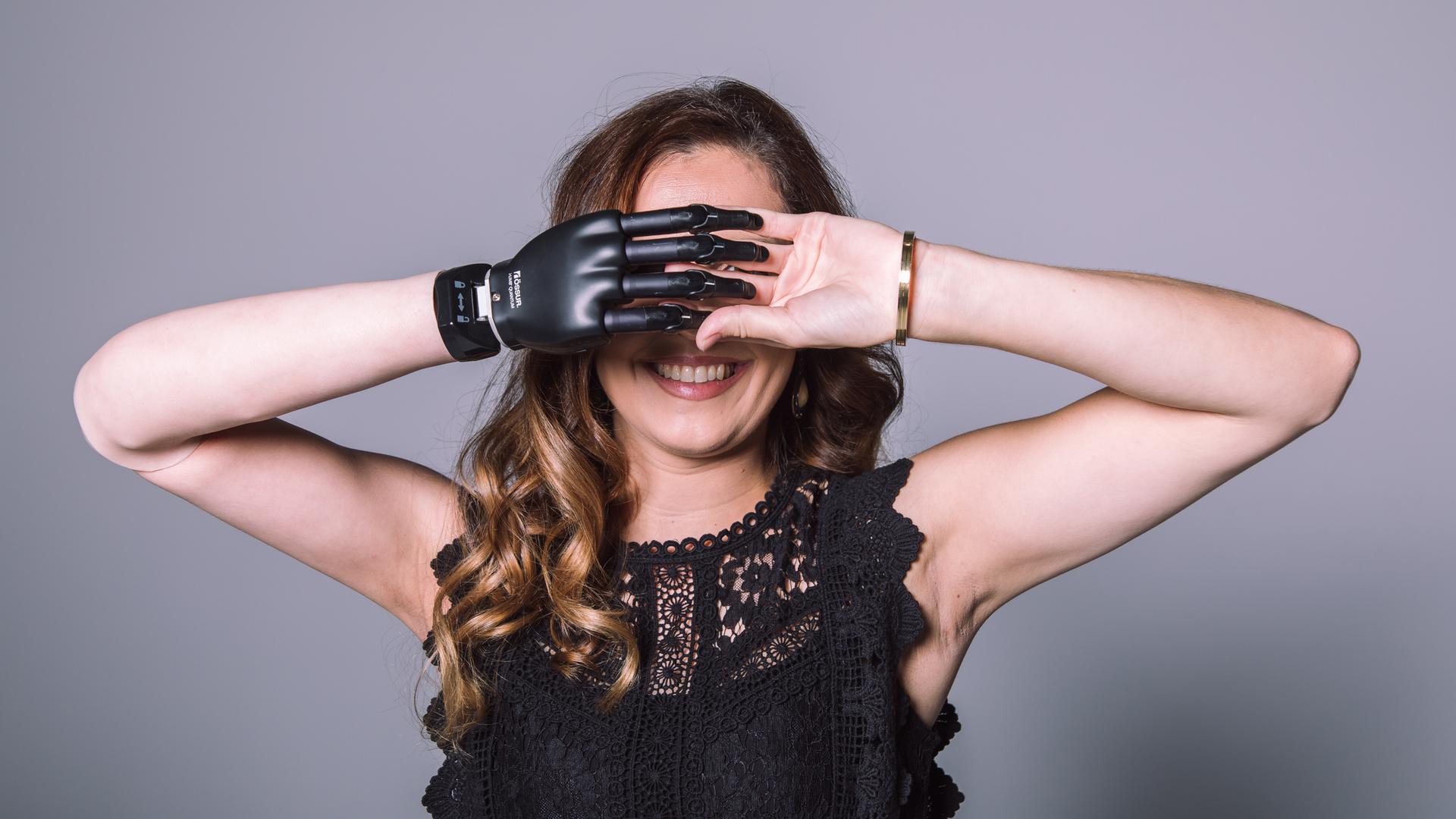 Eine Frau mit Armprothese posiert für ein Foto mit verschränkten Händen vor dem Gesicht.