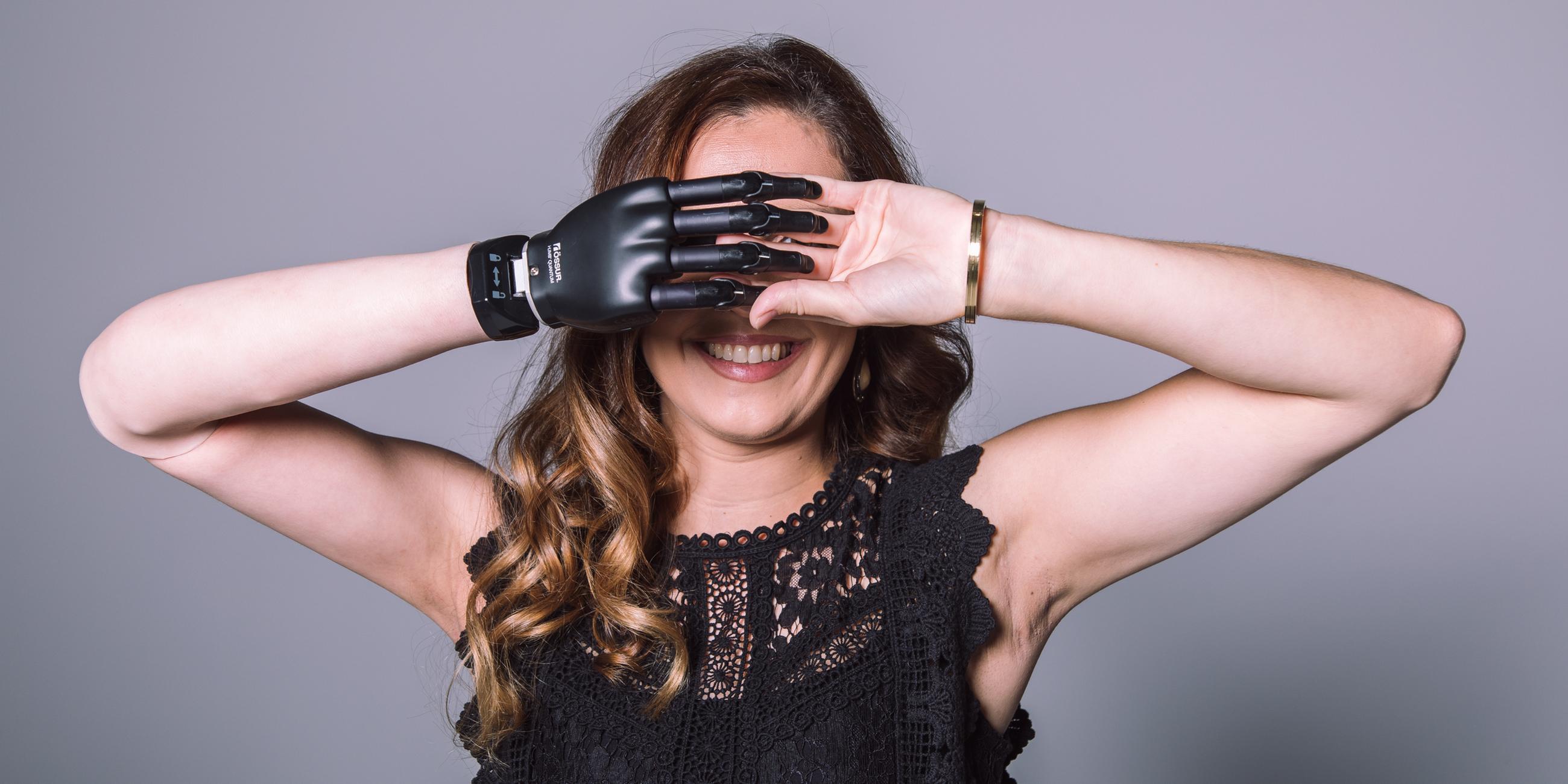 Eine Frau mit Armprothese posiert für ein Foto mit verschränkten Händen vor dem Gesicht.