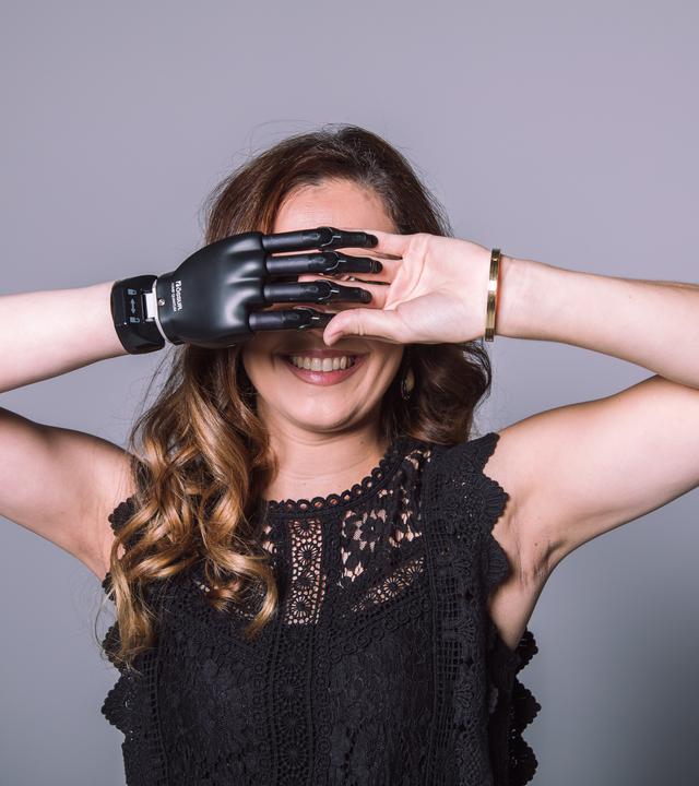 Eine Frau mit Armprothese posiert für ein Foto mit verschränkten Händen vor dem Gesicht.