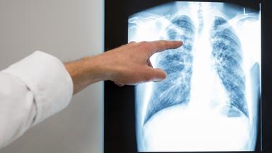 Nano - Nano Vom 29. März 2022: Tuberkulose - Ansteckend Und Gefährlich