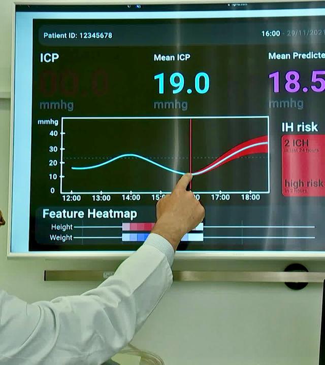 Bildschirm mit Kurven und Verlauf zu Patientenzustand