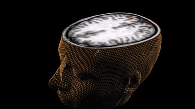 Nano - Nano Vom 28. September 2023: Zehn Jahre Human Brain Project