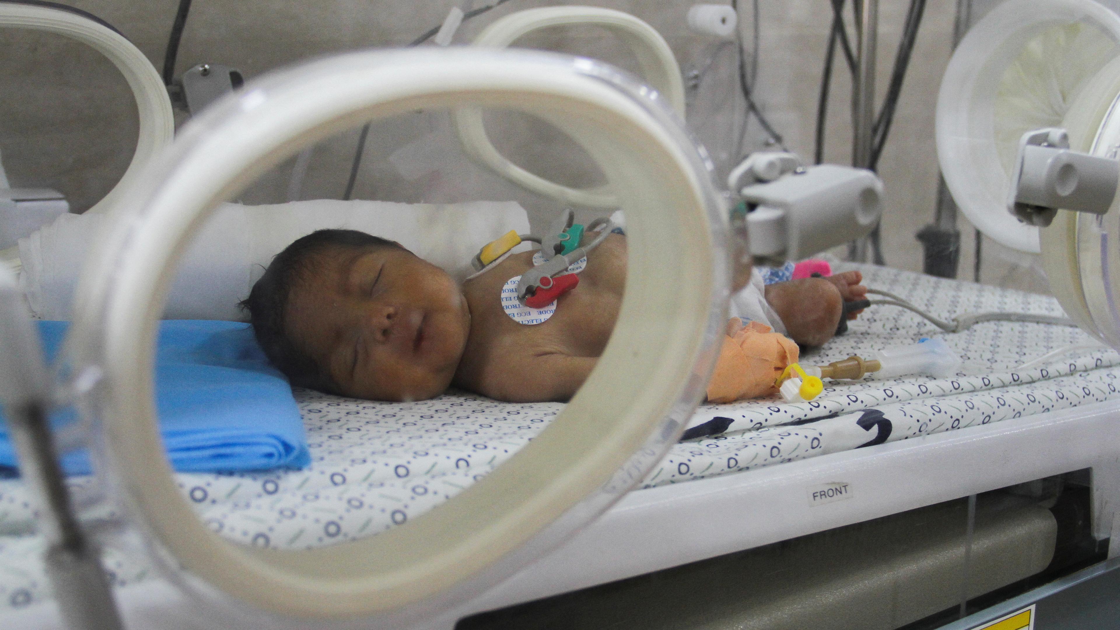 Ein unterernährtes palästinensisches Kind wird im Kamal-Adwan-Krankenhaus im nördlichen Gazastreifen während des anhaltenden Konflikts zwischen Israel und der Hamas behandelt.
