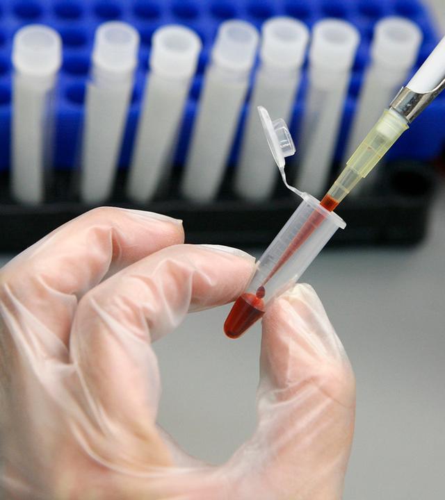 240118_sichelzell_nano