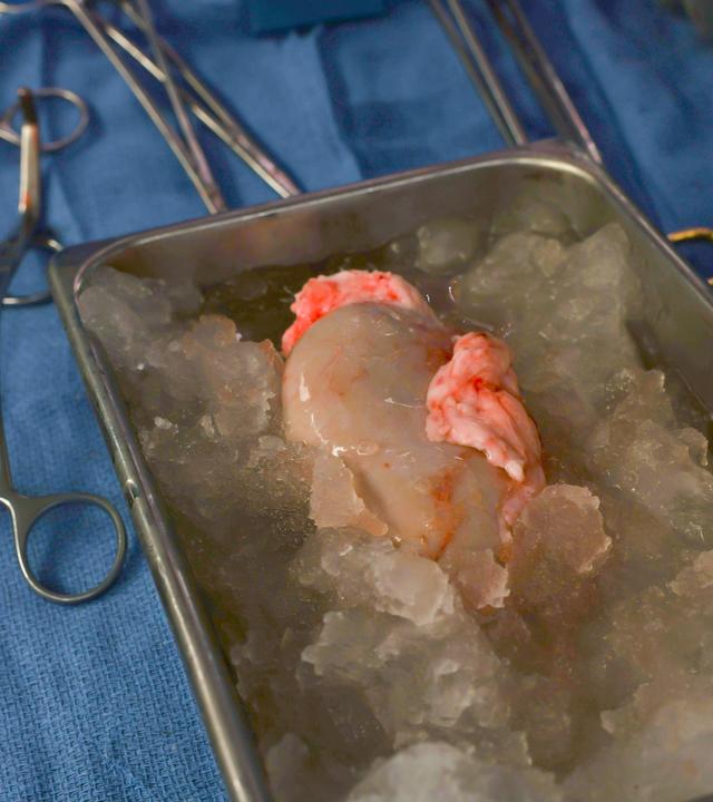Xenotransplantation einer Schweineniere
