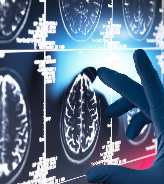 Hirnscans