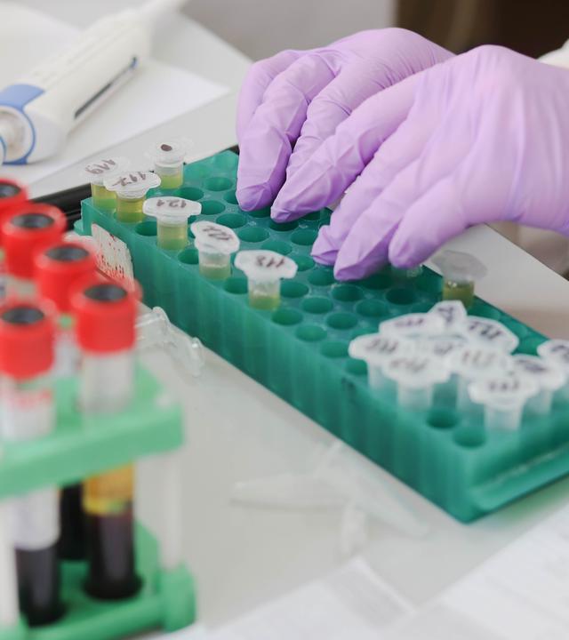 Zell-Immuntherapie - erfolge ind er Nierenkrebsforschung. (Bild zeigt eine Laborumgebung, in der Proben verarbeitet werden)