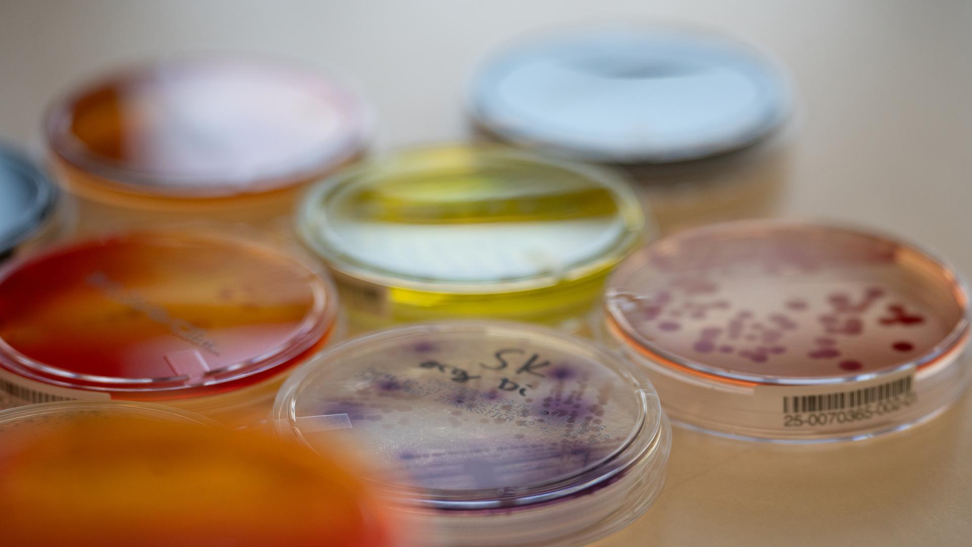 Bakterien in mehreren Schalen; sie wirken normal, doch Forschende warnen, dass spiegelverkehrte Varianten völlig anders reagieren und schwer kontrollierbar werden könnten.