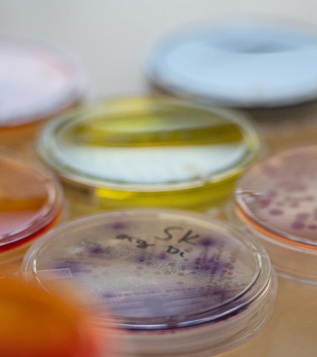 Bakterien in mehreren Schalen; sie wirken normal, doch Forschende warnen, dass spiegelverkehrte Varianten völlig anders reagieren und schwer kontrollierbar werden könnten.