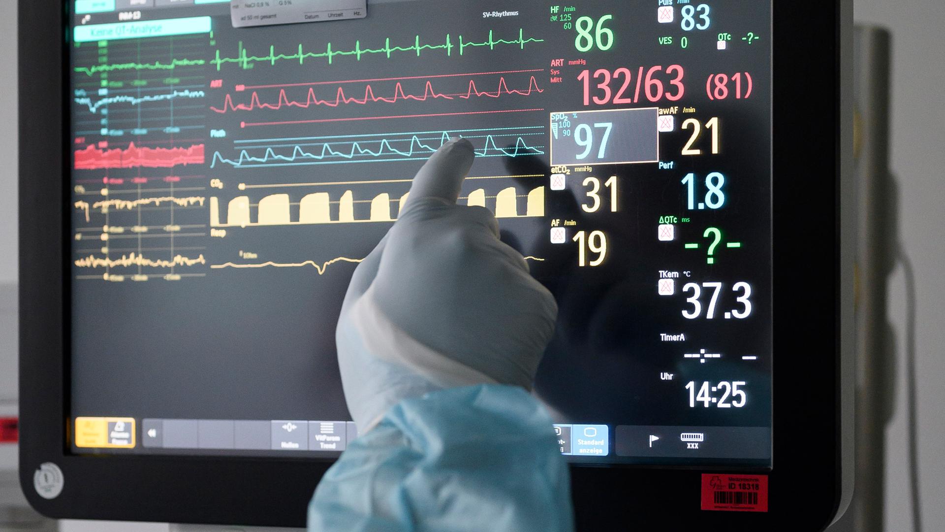 Lebensverlängernde Maßnahmen retten nicht immer – manchmal nehmen sie Würde. Wo liegt die Grenze des medizinisch Machbaren? (Im Bild: Display mit den Werten eines Patienten) 