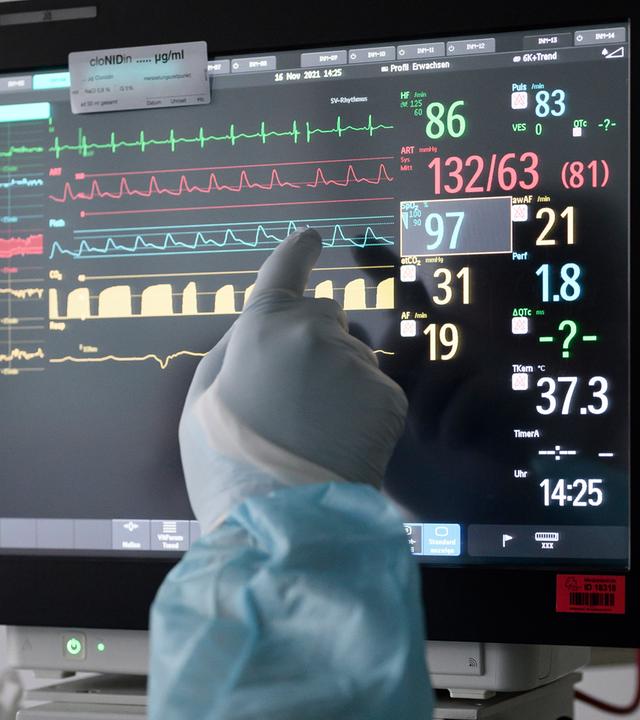 Lebensverlängernde Maßnahmen retten nicht immer – manchmal nehmen sie Würde. Wo liegt die Grenze des medizinisch Machbaren? (Im Bild: Display mit den Werten eines Patienten) 