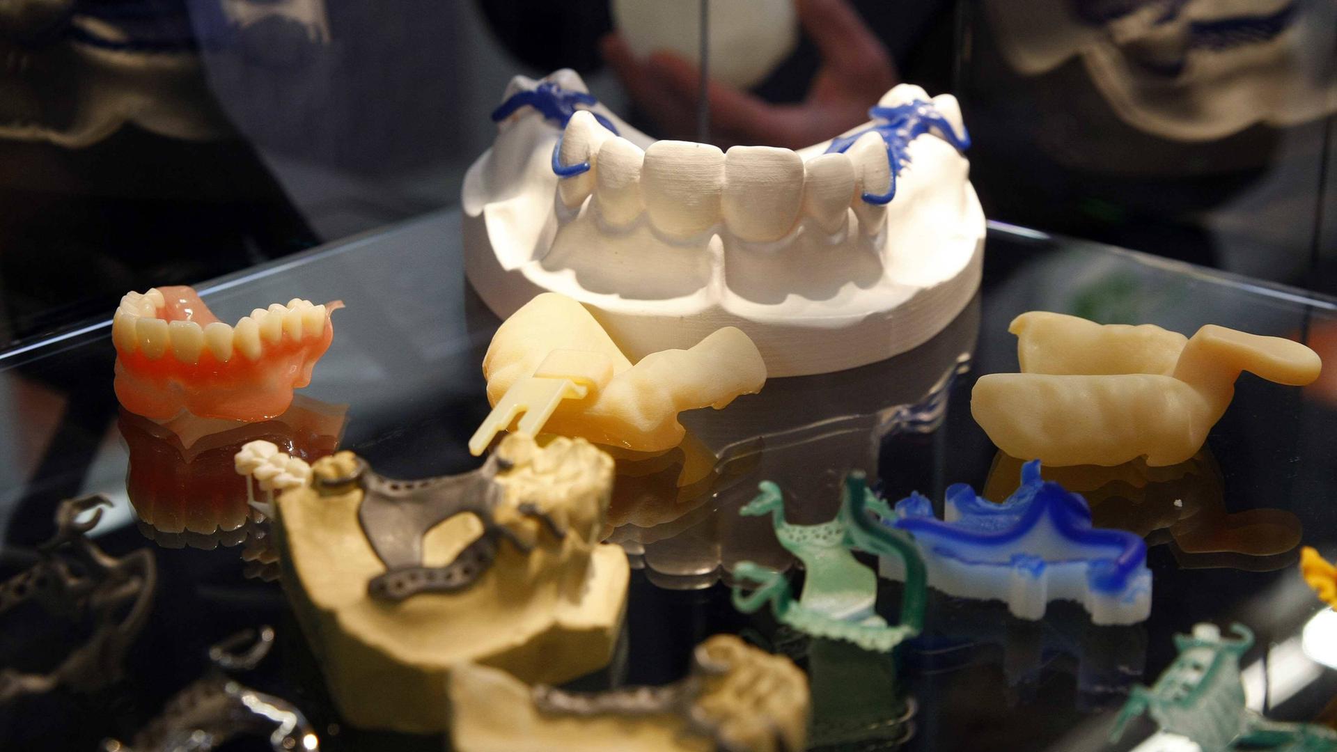 3D-Technik bei Zahnersatz