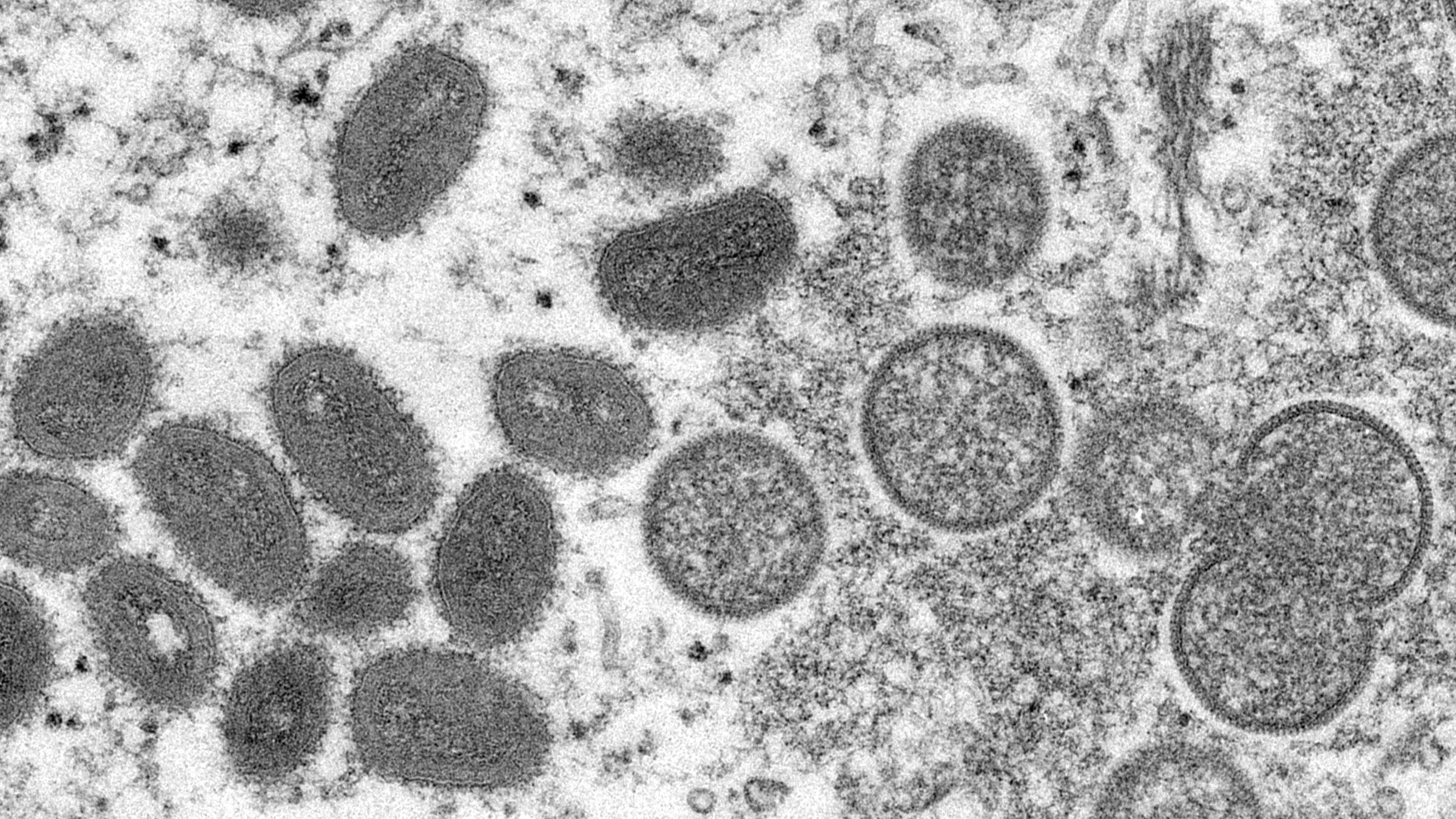 Diese elektronenmikroskopische Aufnahme aus dem Jahr 2003, die von den Centers for Disease Control and Prevention zur Verfügung gestellt wurde, zeigt reife, ovale Affenpockenviren und kugelförmige unreife Virionen, die aus einer menschlichen Hautprobe im Zusammenhang mit dem Präriehundeausbruch von 2003 stammt. 