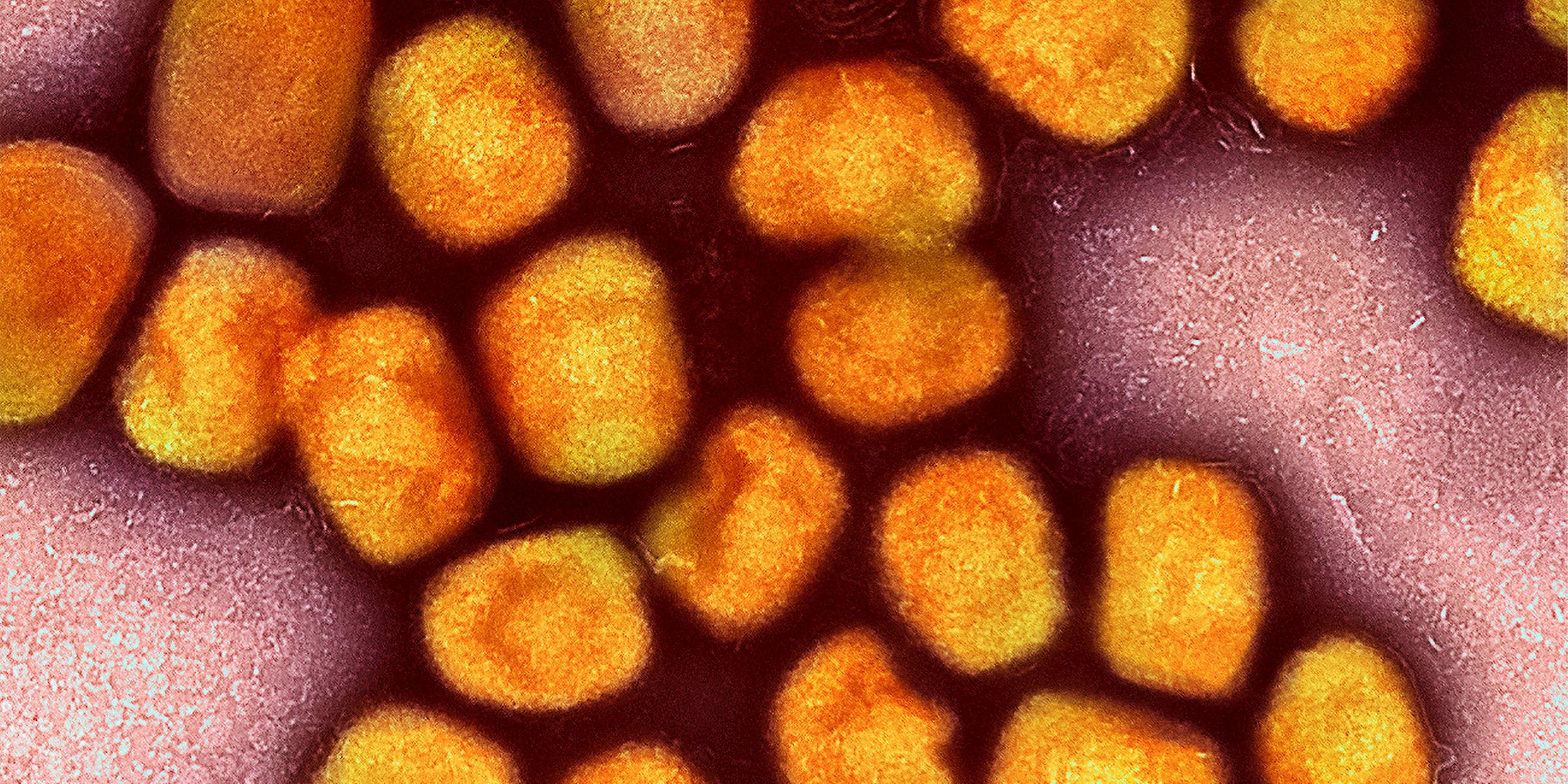 Affenpocken-Virus unter dem Elektronenmikroskop