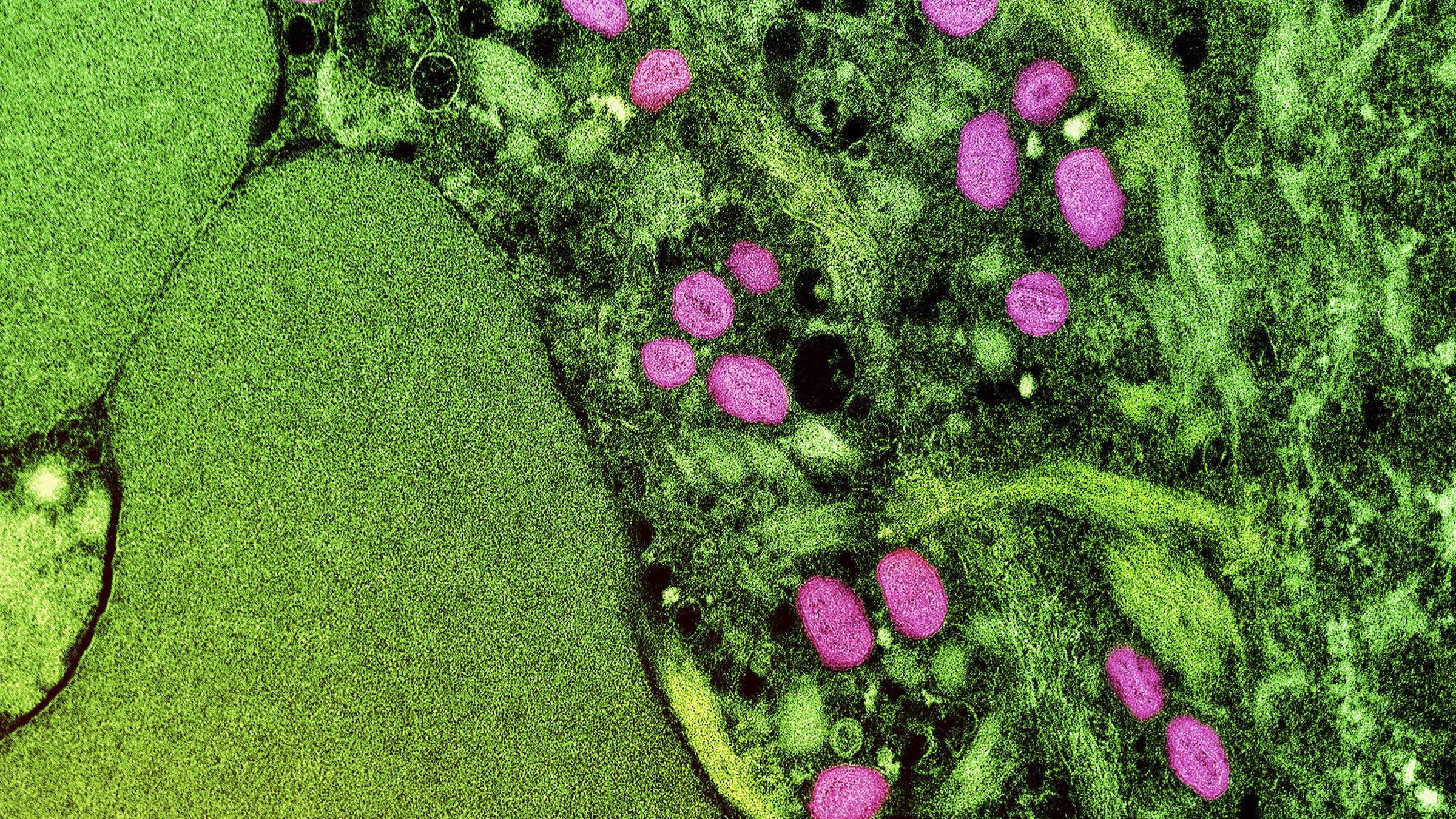 USA, Fort Detrick: Eine kolorierte transmissionselektronenmikroskopische Aufnahme von Partikeln des Affenpockenvirus
