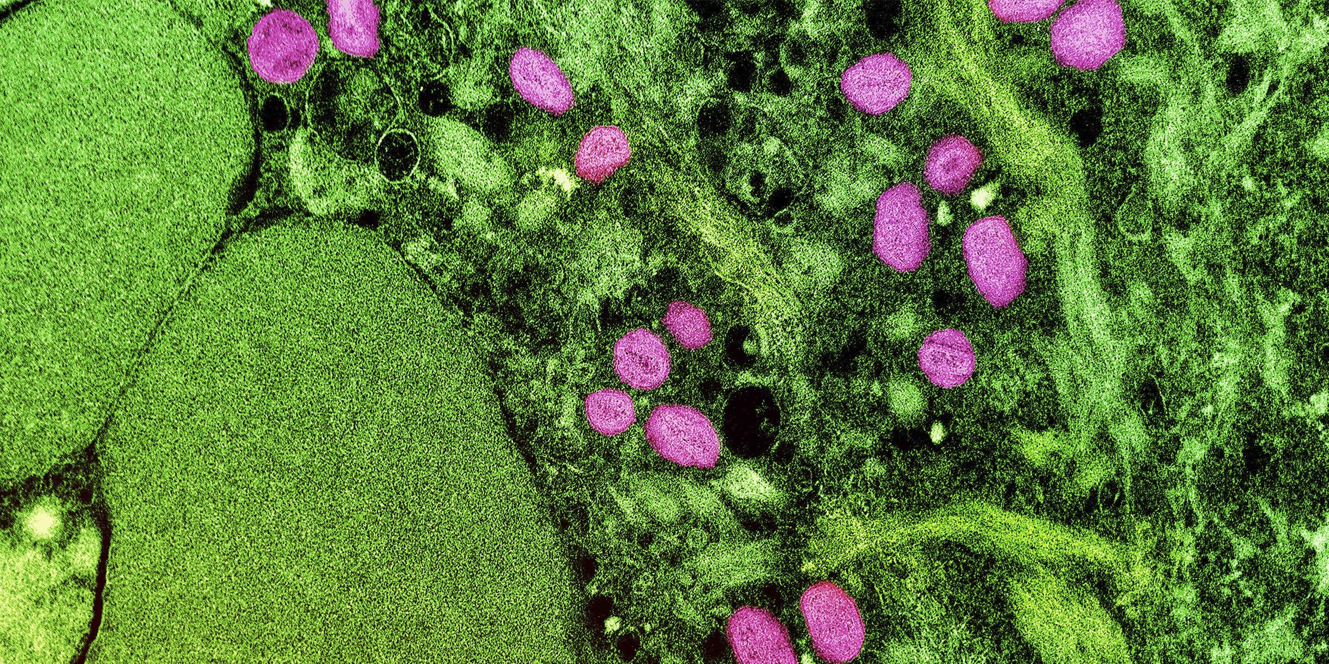 USA, Fort Detrick: Eine kolorierte transmissionselektronenmikroskopische Aufnahme von Partikeln des Affenpockenvirus