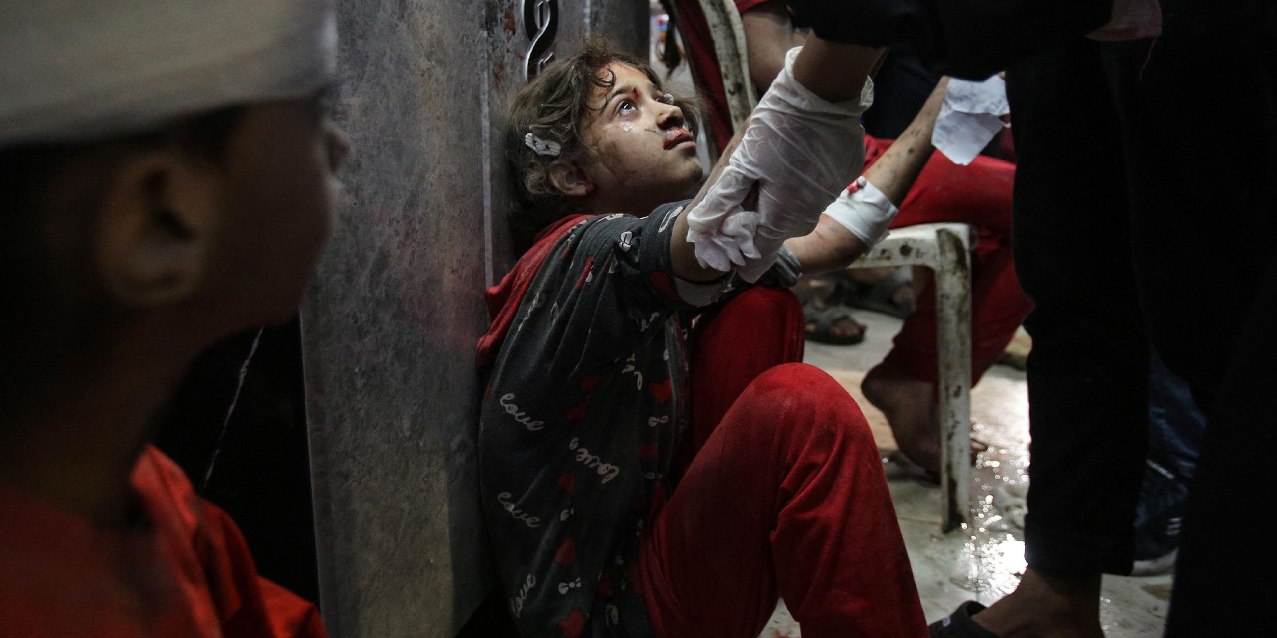 Ein junges verletztes Mädchen wartet in der Notaufnahme des Al-Shifa-Krankenhauses nach einem israelischen Angriff am 05.11.2023 in Gaza-Stadt auf seine Behandlung.