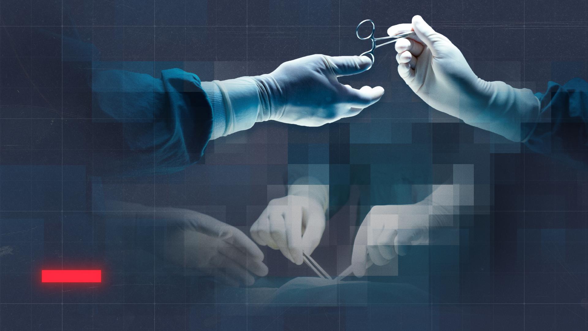 Hände von Operierenden übergeben eine Schere.