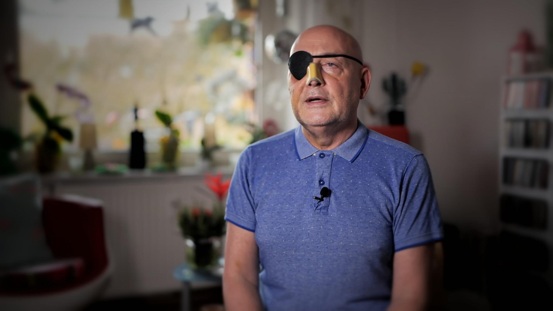 Andreas Roger mit Augenklappe und Nasenbandage