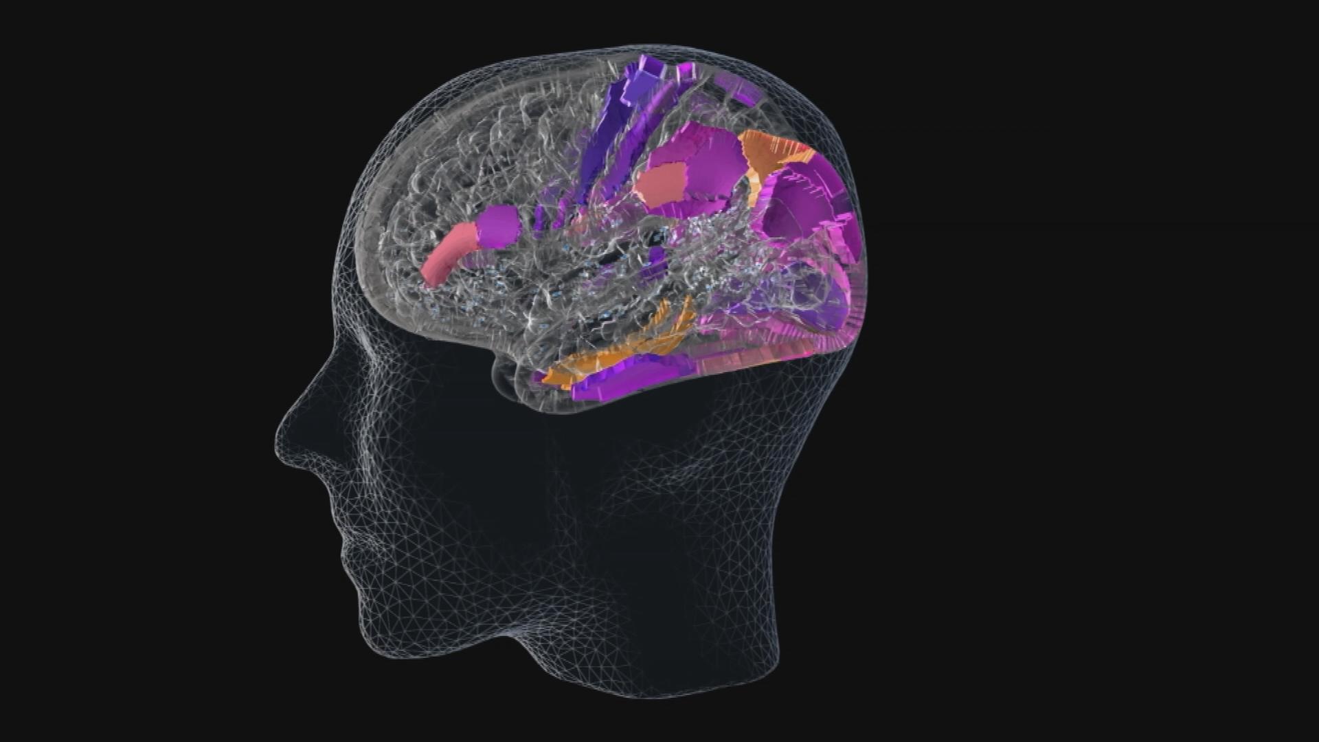Auf dem Bild ist ein animiertes Gehirn zu sehen.