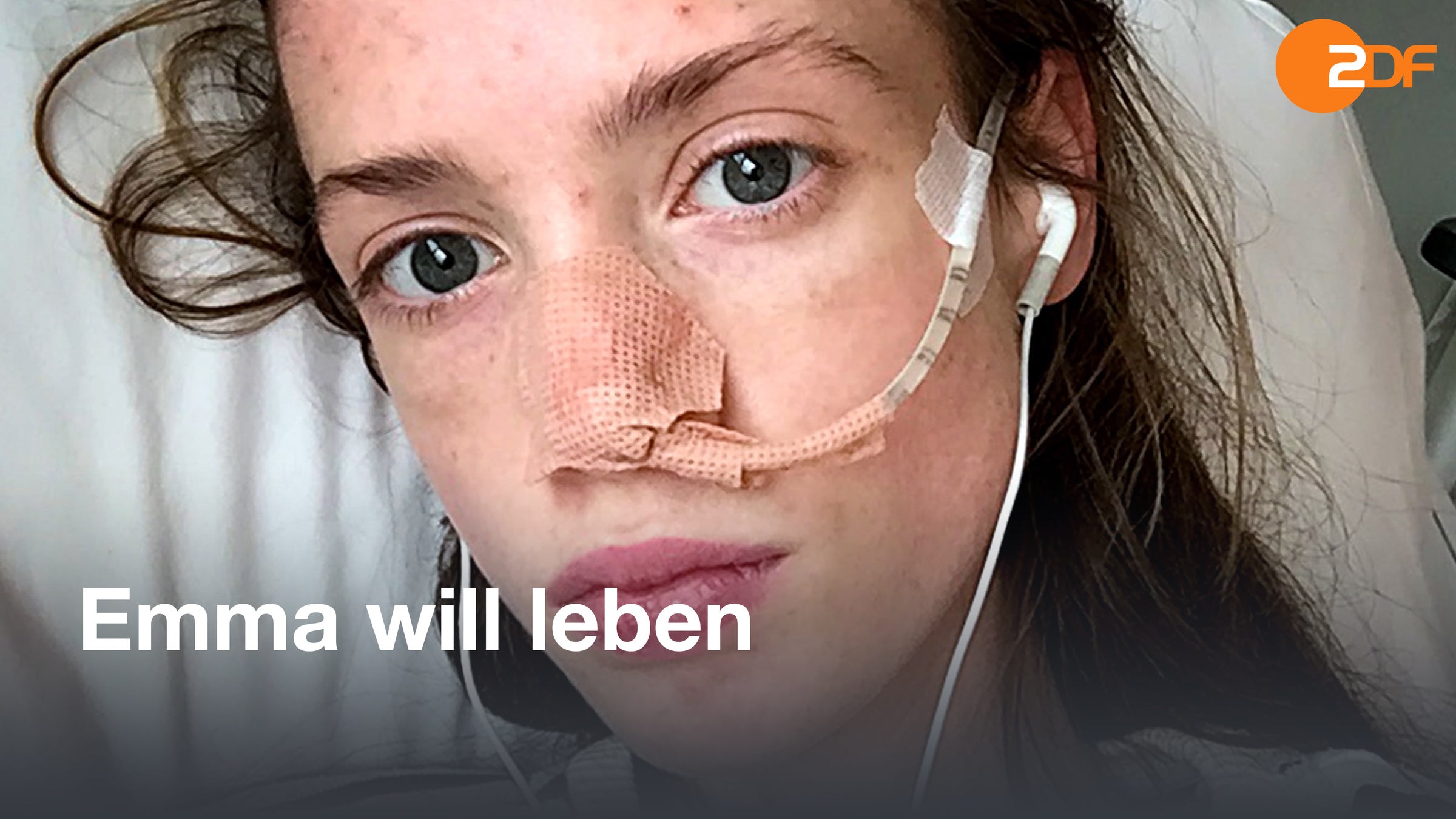 "Emma will leben" - Nahaufnahme : Gesicht eines extrem abgemagerten Mädchens. Eine Sonde (dünner Schlauch) führt in ihre Nase. Die Nase ist mit Pflaster verklebt, damit die Sonde besser hält.