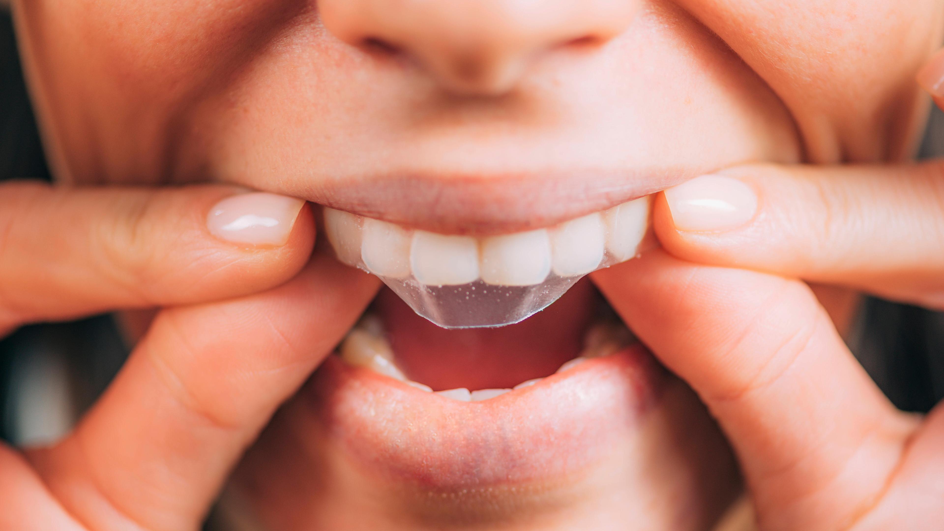 Zähne werden mit einem Streifen beklebt, um die Zähne zu bleichen