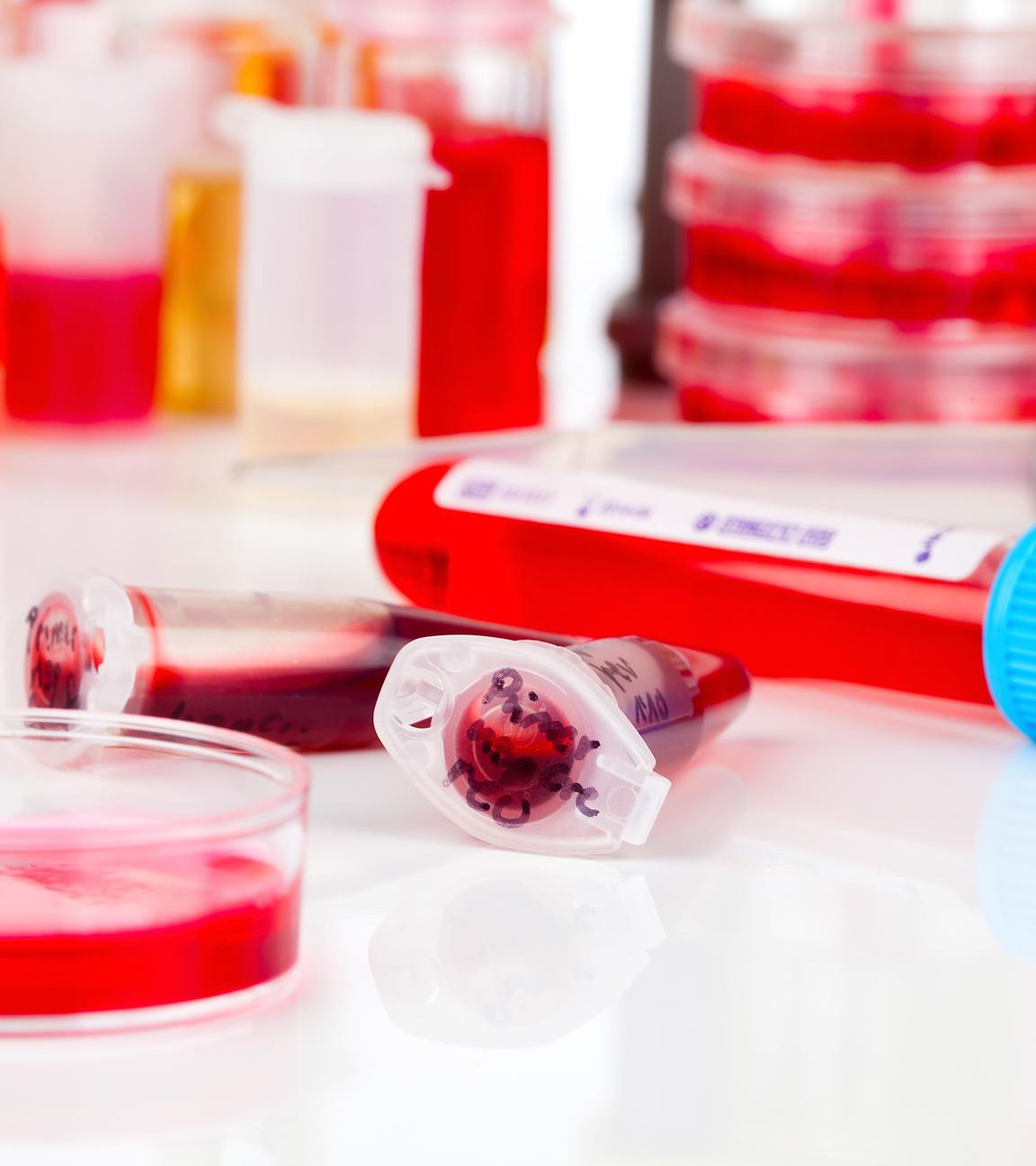Auf einem Tisch in einem Labor liegen Petrischalen und Probenbehälter, gefüllt mit Blutproben.