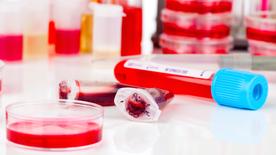 Des boîtes de Pétri et des récipients à échantillons remplis d'échantillons de sang se trouvent sur une table dans un laboratoire.