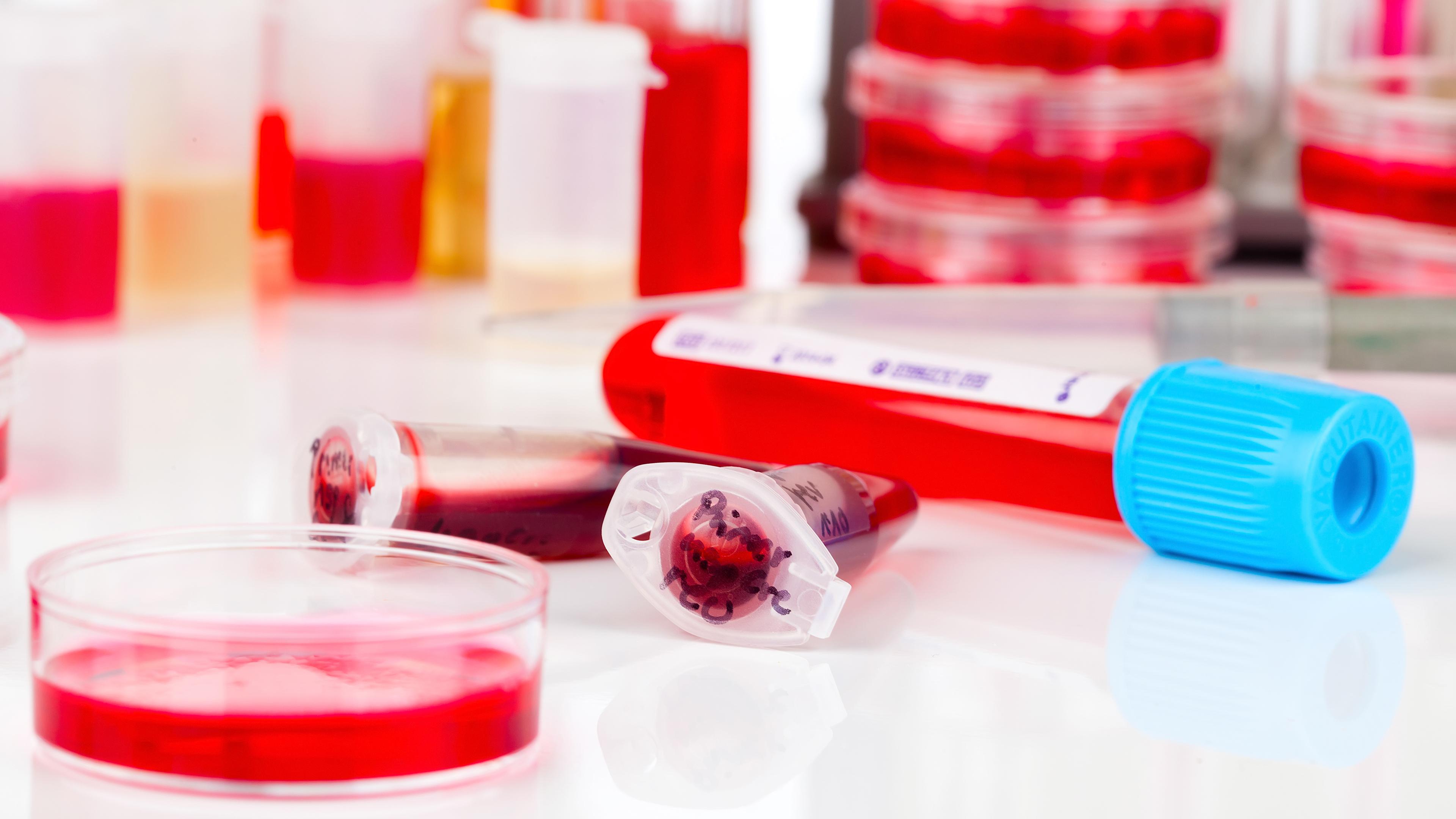 Auf einem Tisch in einem Labor liegen Petrischalen und Probenbehälter, gefüllt mit Blutproben.