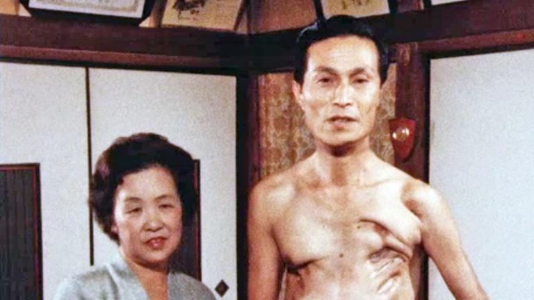 "Hiroshima, Nagasaki - Atombombenopfer sagen aus": Eine japanische Frau (links) und ein Mann (rechts) mit nacktem Oberkörper, blicken in die Kamera.