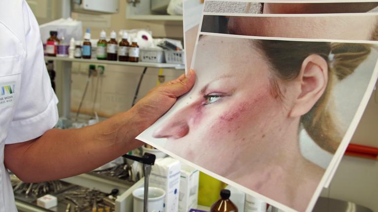 "plan b: Hinsehen und handeln - Gewalt gegen Frauen verhindern": Eine Person in weißem Kittel hält in einem Labor ein Foto in der Hand, auf dem eine Frau mit Bluterguss auf der Wange zu sehen ist.