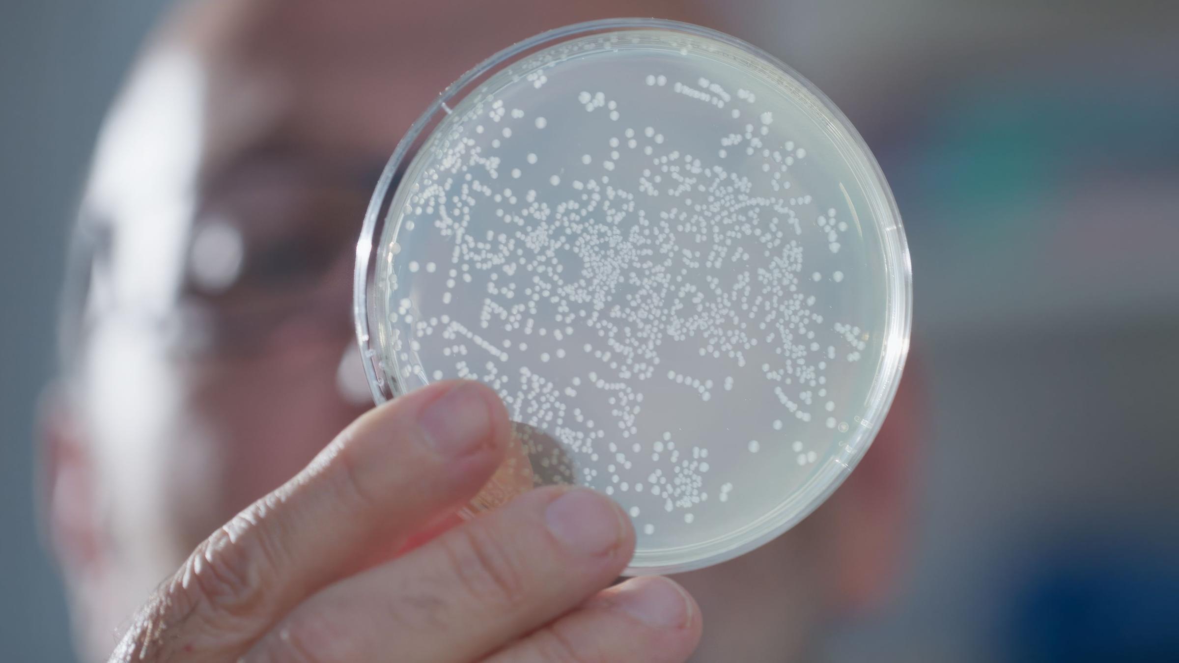 "Winzige Antikörper": Forscher betrachtet eine Bakterienkultur.