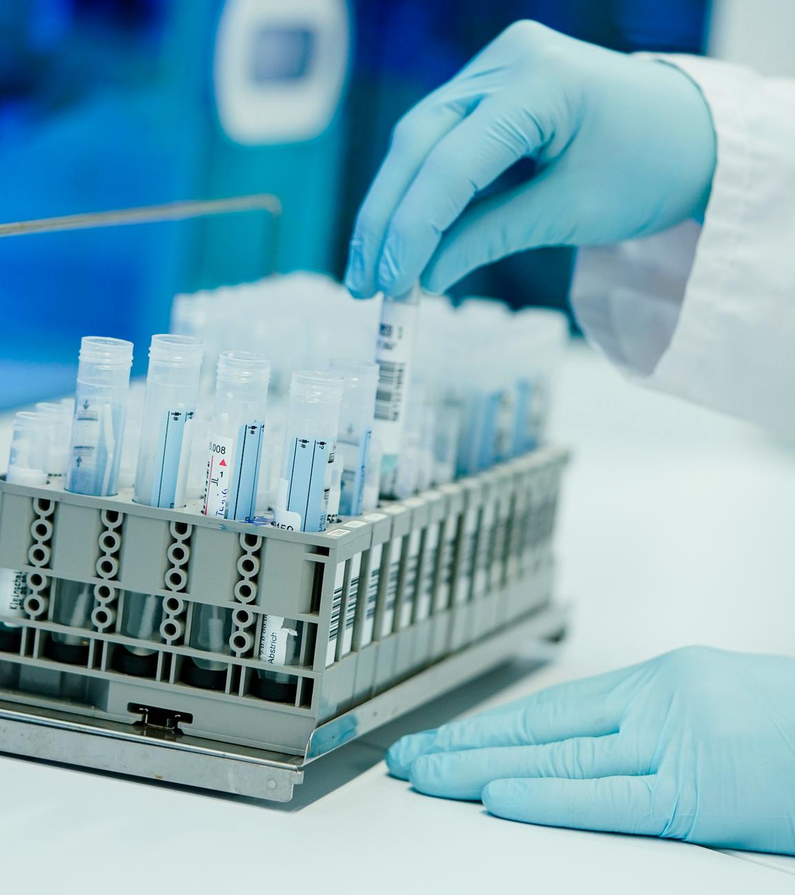 Archiv:  Ein Mitarbeiter hält in einem Coronatest-Labor der Limbach Gruppe PCR-Teströhrchen in den Händen. 