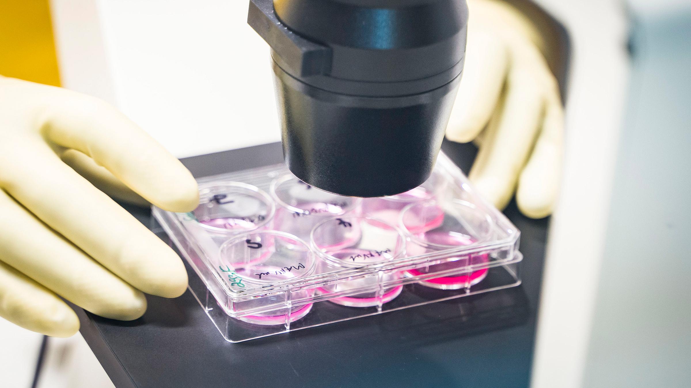 Archiv: Ein Mitarbeiter arbeitet in einem Labor an Organismen im Hochsicherheitsbereich des Instituts für Virologie in Marburg.