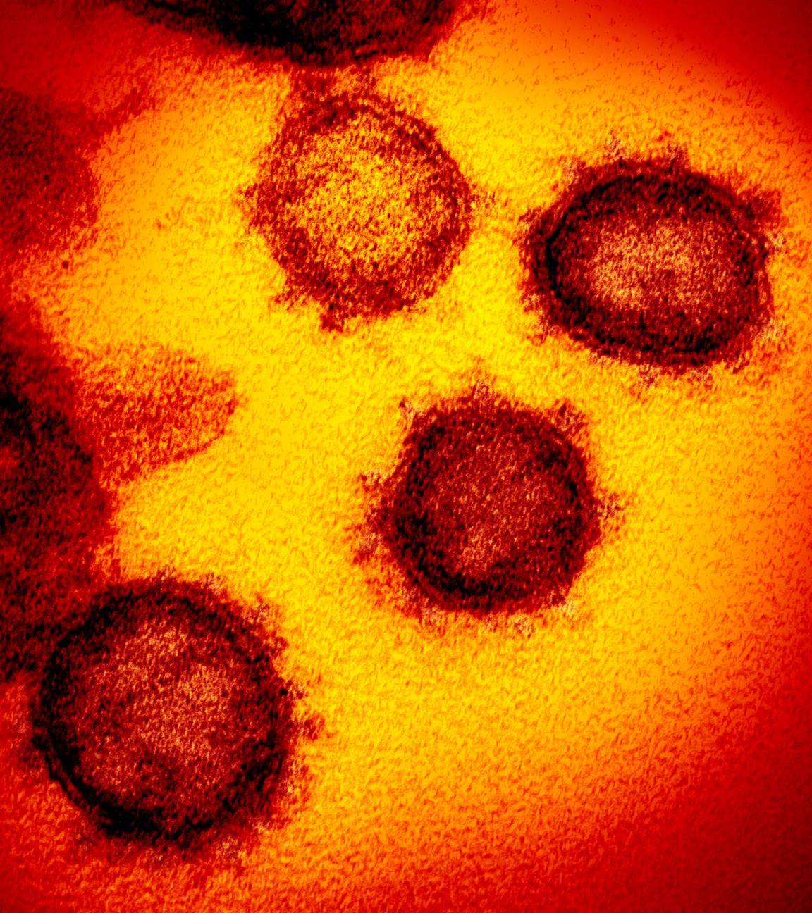 eine undatierte elektronenmikroskopische aufnahme des «u.s. national institute of health» zeigt das neuartige coronavirus