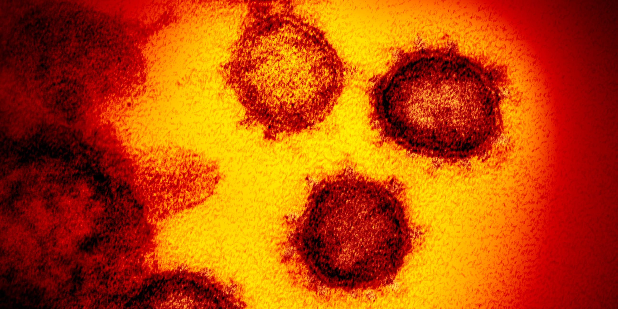 eine undatierte elektronenmikroskopische aufnahme des «u.s. national institute of health» zeigt das neuartige coronavirus