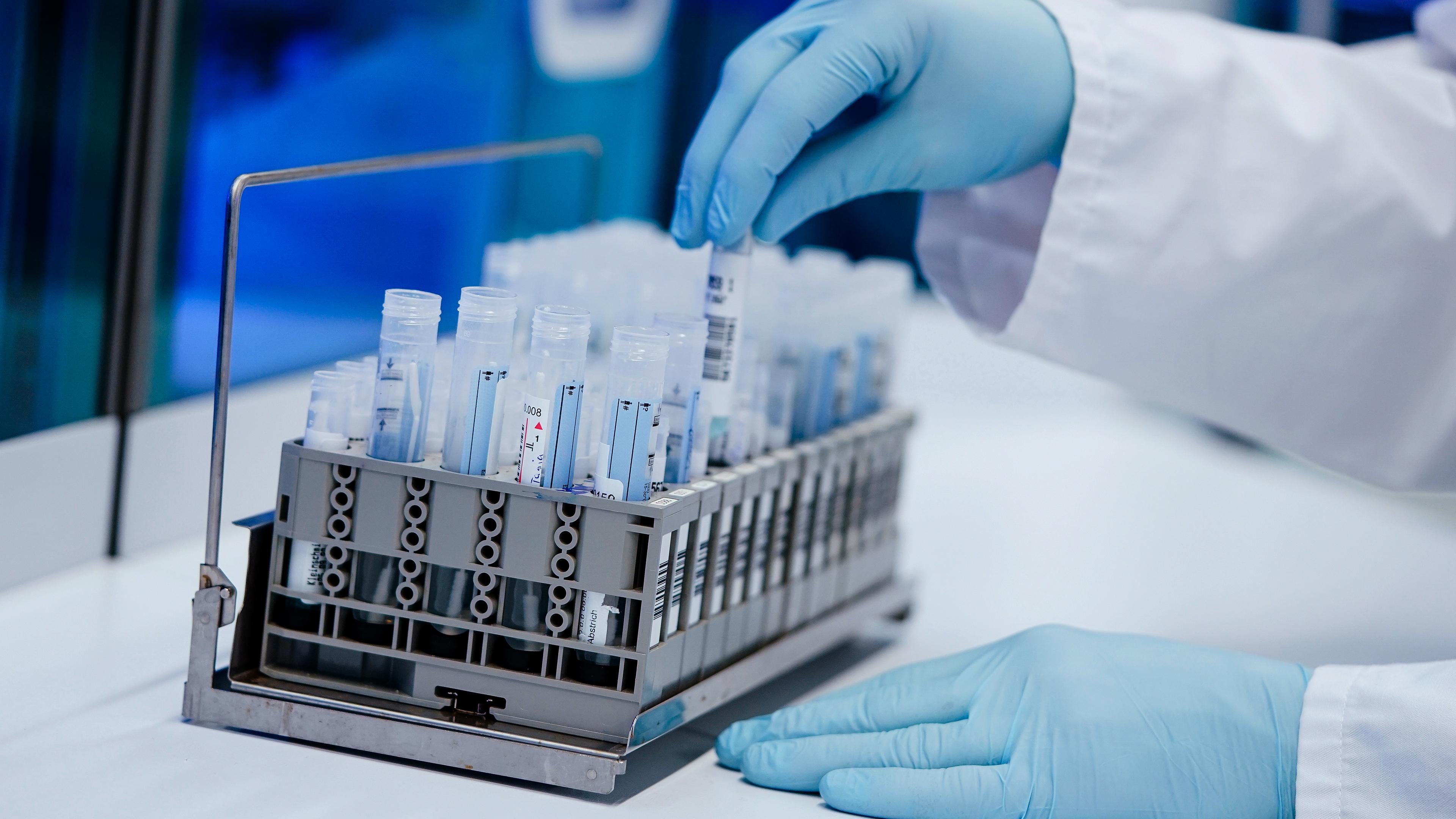 Ein Mitarbeiter hält in einem Coronatest-Labor der Limbach Gruppe PCR-Teströhrchen in den Händen