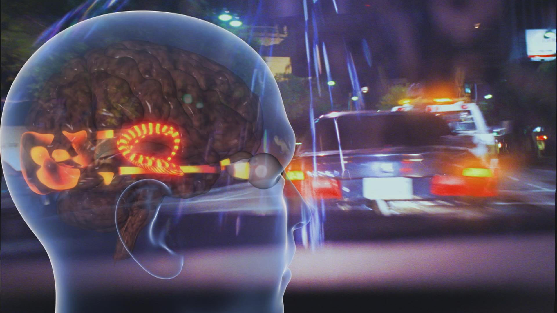 Grafik: Gehirn/Unfallszene