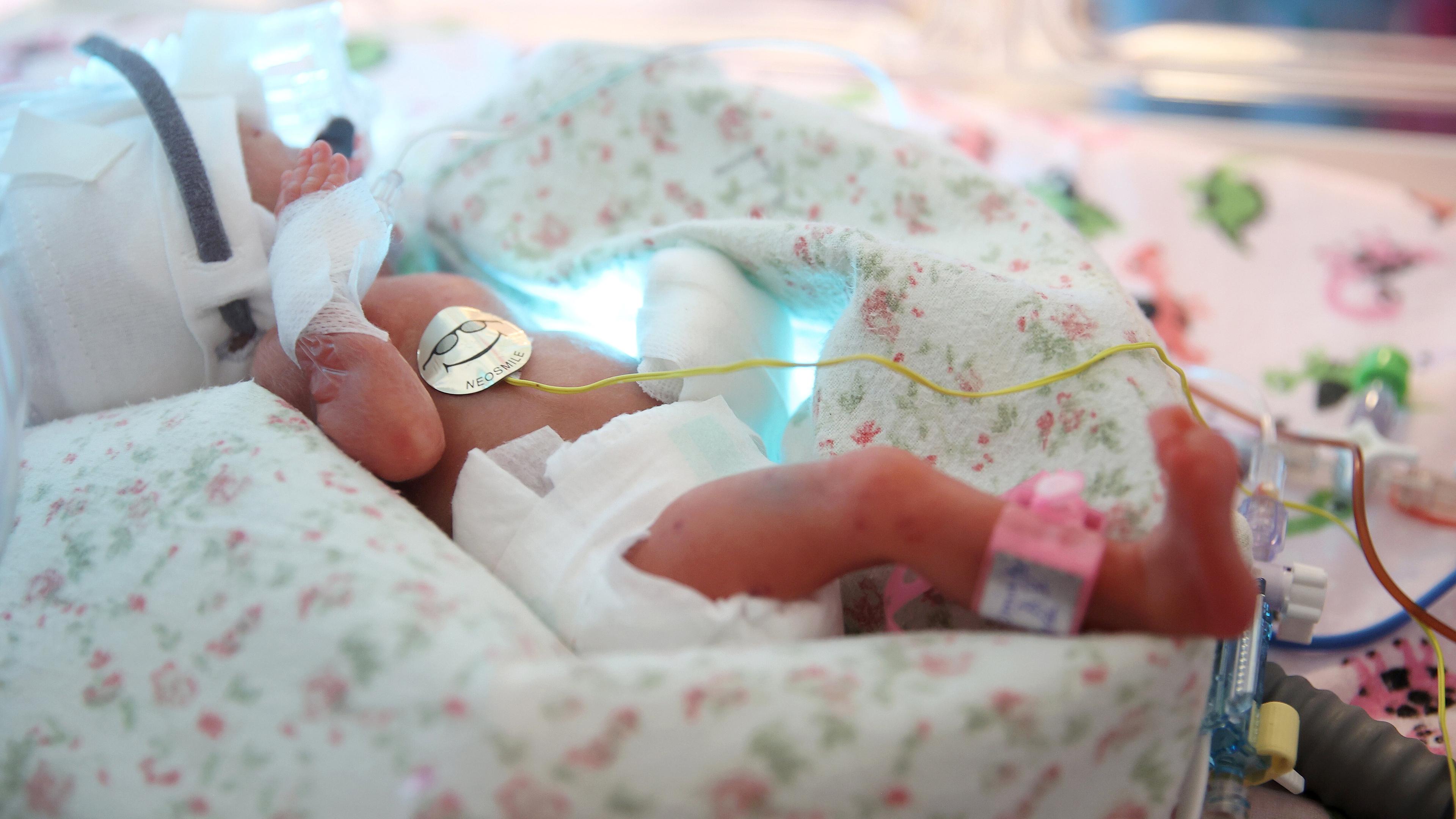 Ein neugeborenes Baby von Fünflingen liegt in der Geburtsabteilung des Universitätskrankenhauses in Krakau (Polen), aufgenommen am 14.02.2023 