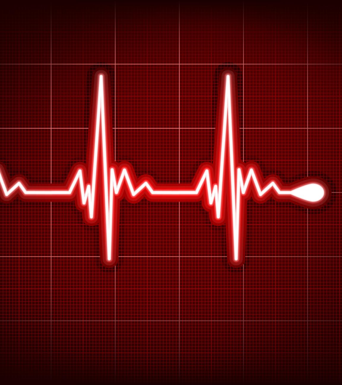 Der Herzrhythmus durch eine Elektrokardiografie (EKG) aufgenommen.