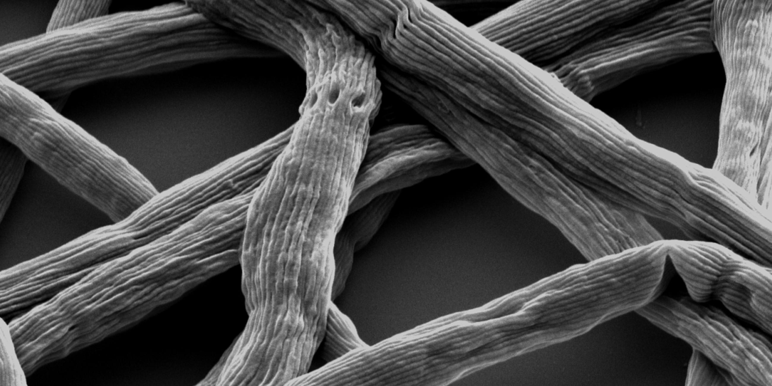 Das Kabelbakterium Electronema unter dem Mikroskop.