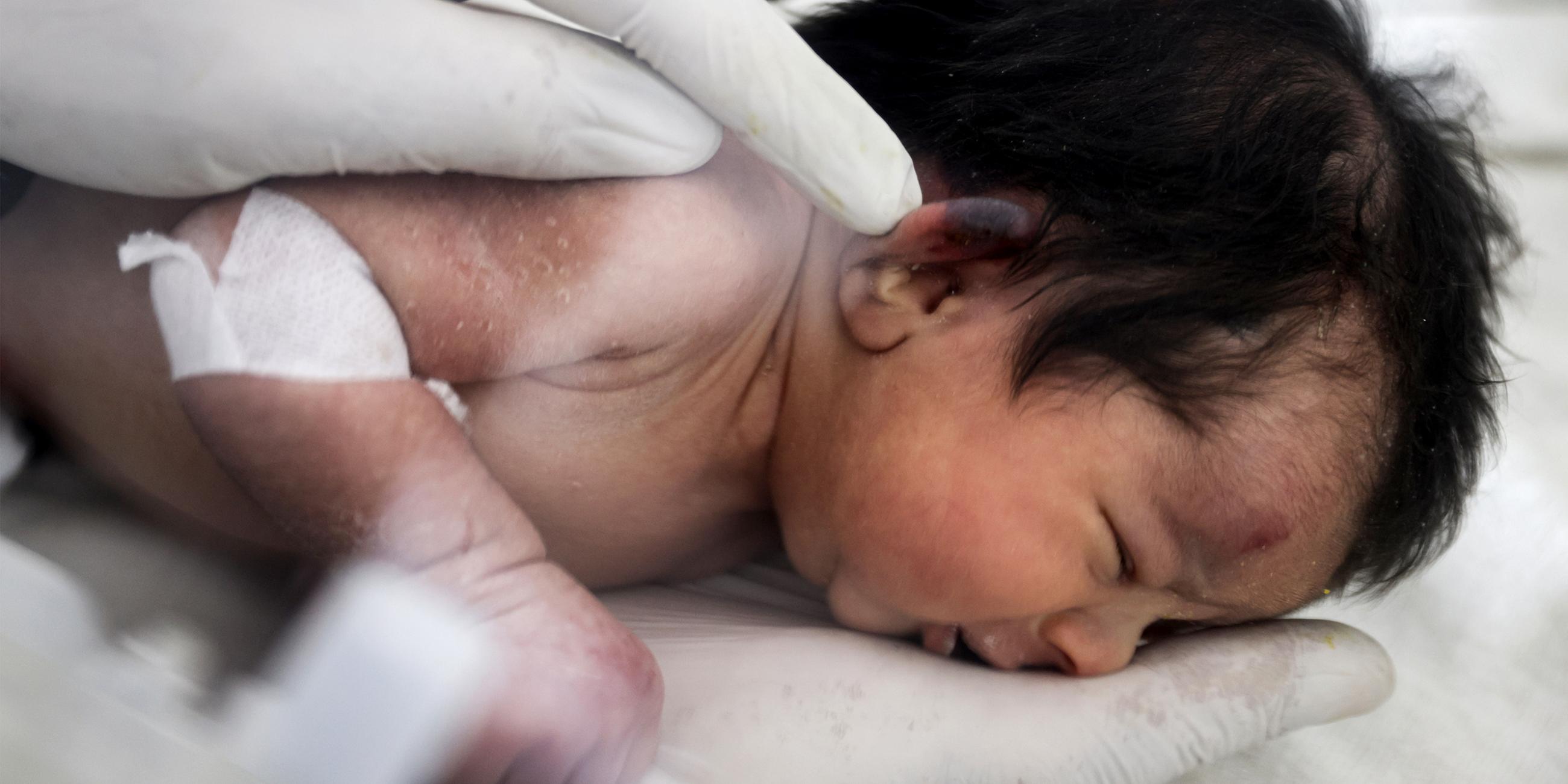 Ein neugeborenes Mädchen wird im Kinderkrankenhaus medizinisch untersucht. 