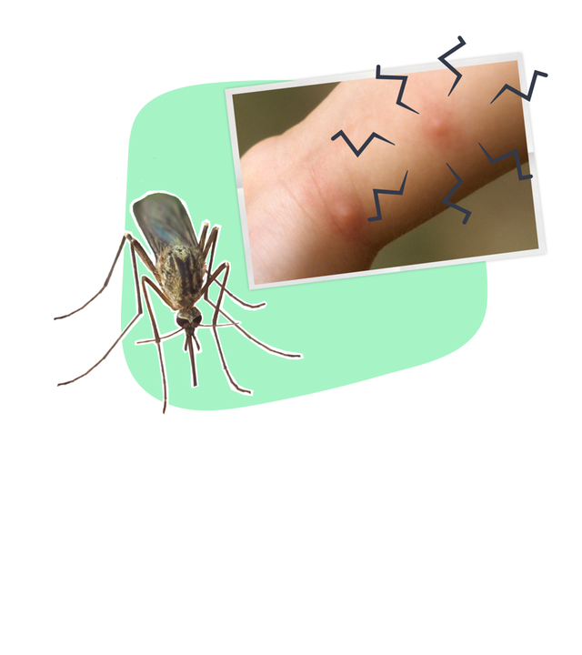 Erklärgrafik Mückenstich