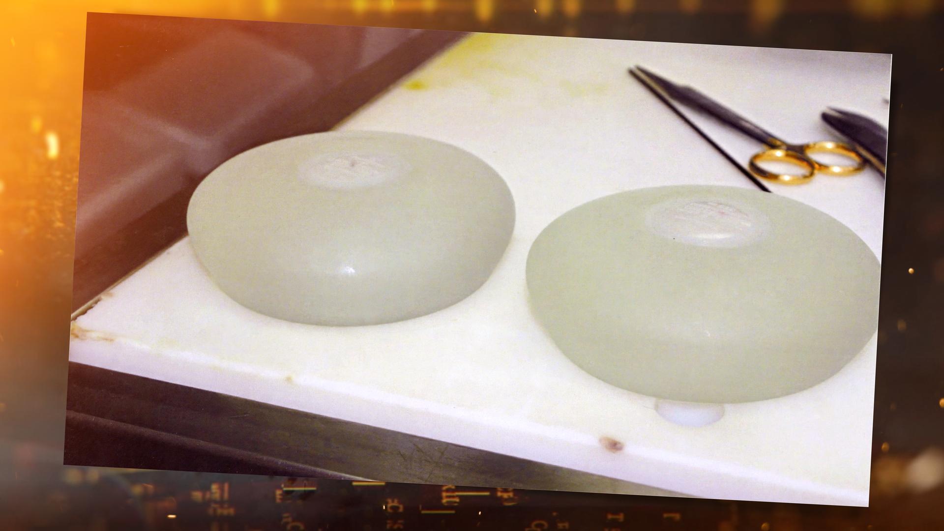 Zwei weiße, ovale Silikonkissen liegen auf einem weißen Marmortisch. Oberhalb des rechten Implantats liegt eine Operationsklammer.