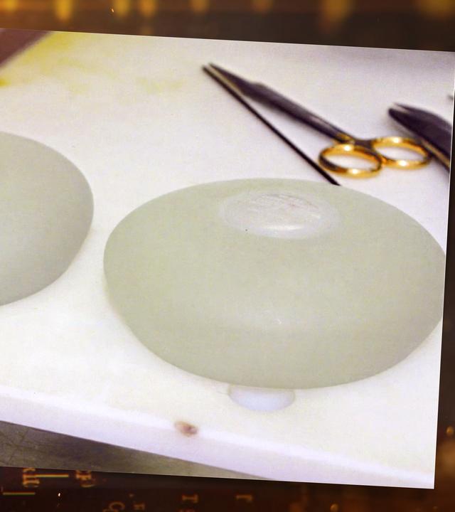 Zwei weiße, ovale Silikonkissen liegen auf einem weißen Marmortisch. Oberhalb des rechten Implantats liegt eine Operationsklammer.