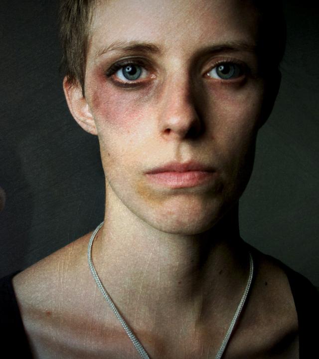  Collage. Rechts eine Frau mit sichtbaren Verletzungen im Gesicht. Links im Hintergrund ein Mann mit zur Faust geballter Hand.