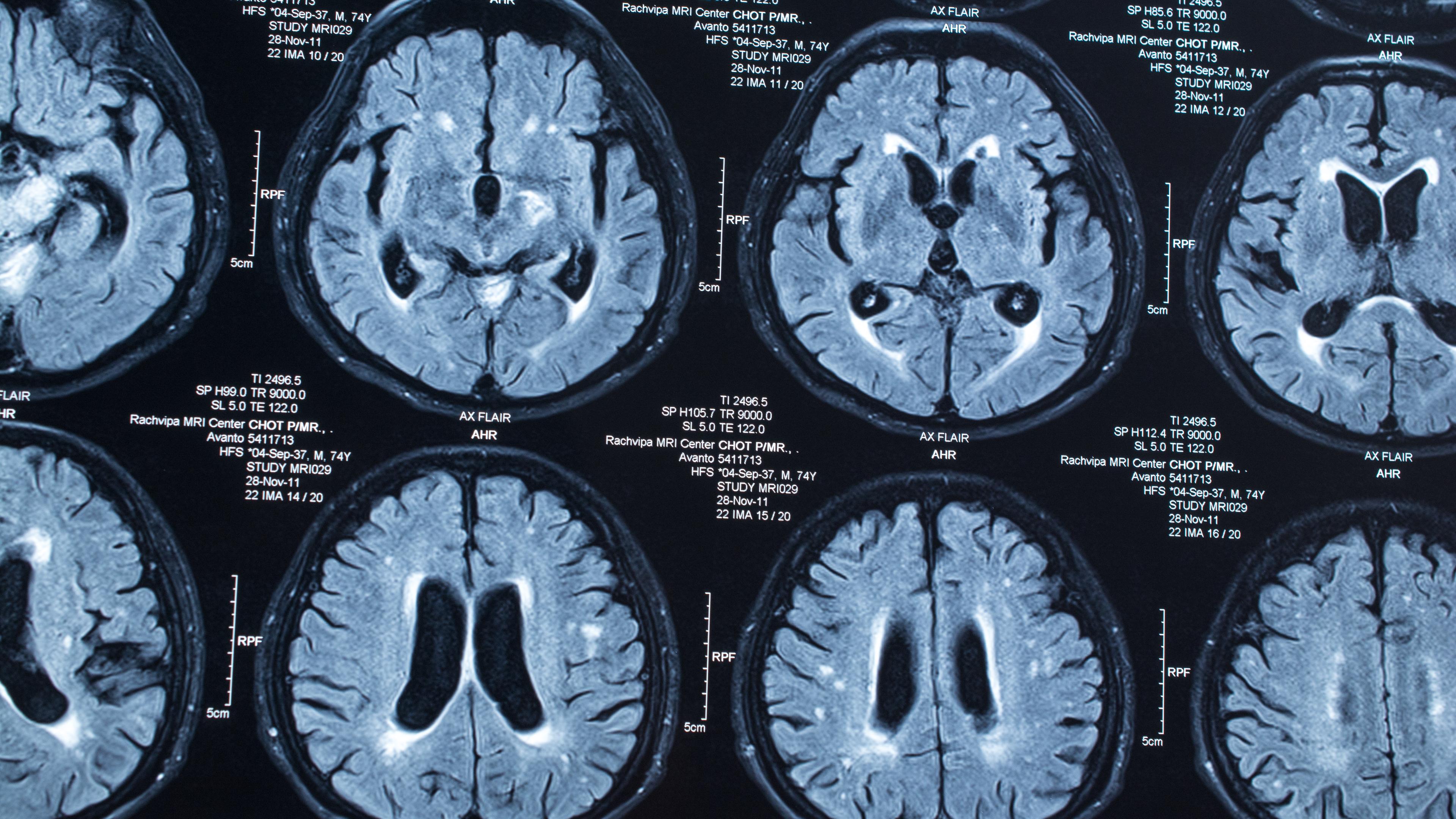 Röntgenbilder des Gehirns