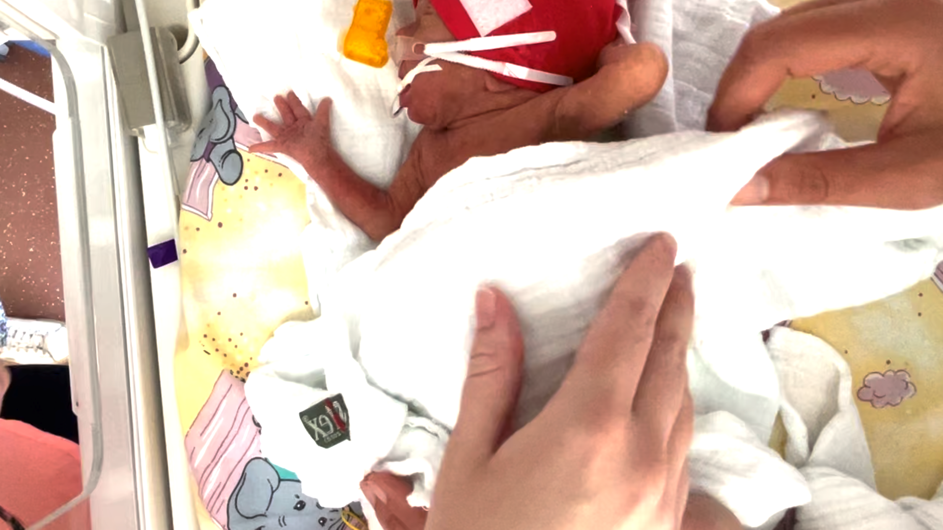 Ein Frühchen im Krankenhaus; Hamburg