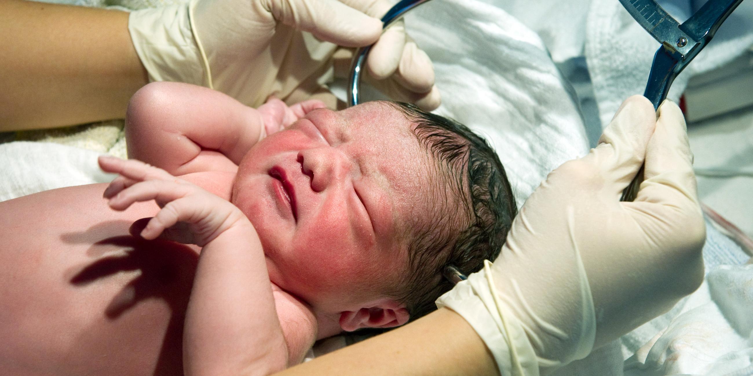 Neugeborenes Kind wird nach der Geburt gemessen.