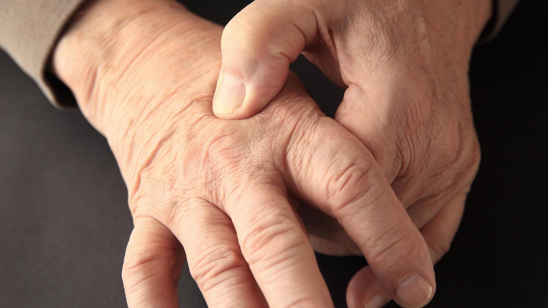 пятна на руках пожилых людей